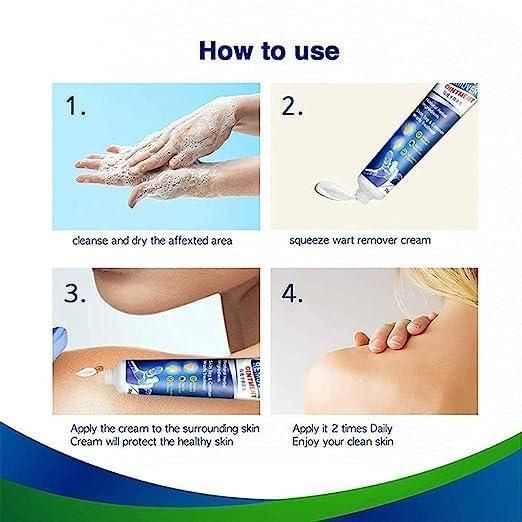WartsOff Instant Blemish Removal Cream Warts Off Instant Blemish Removal Cream 20 g Wart Remover Ointment for All Skin Types (Pack of 1)